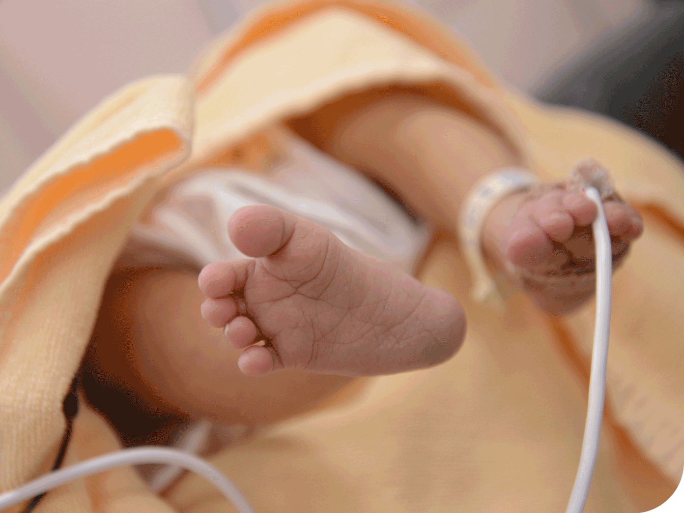 Newborn being monitored