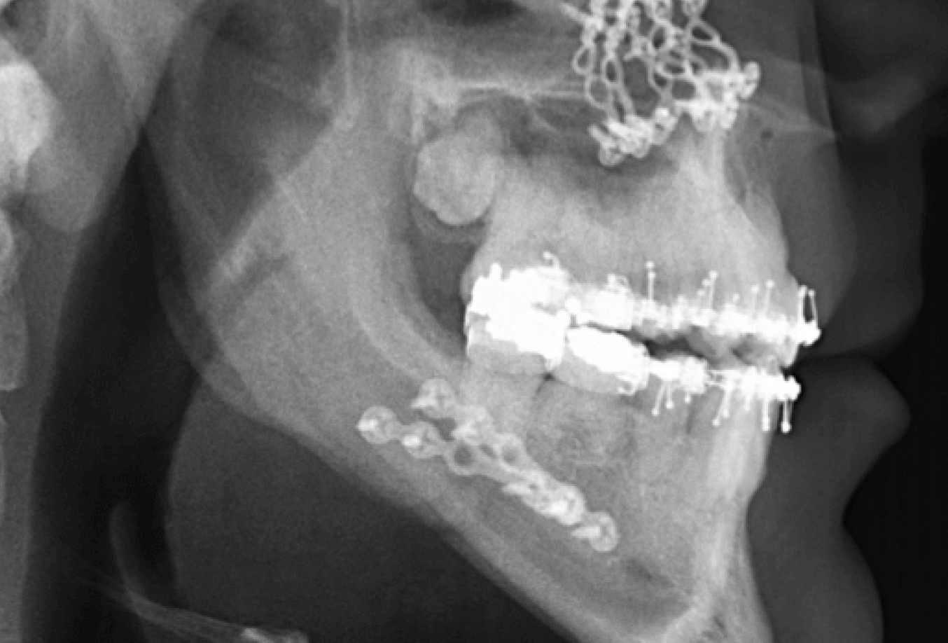 X-ray of human jaw and teeth